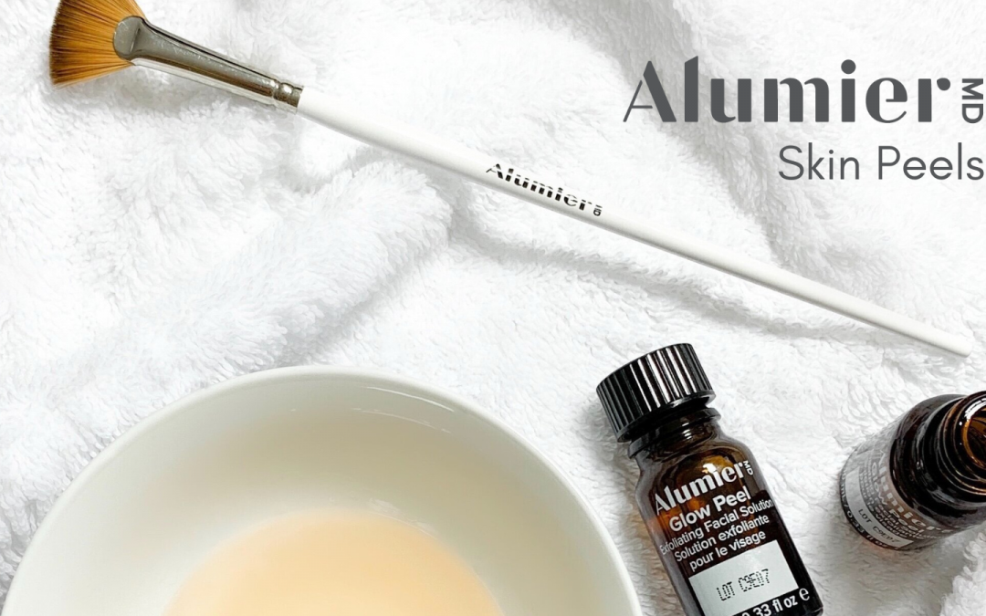 What Are Chemical Peels & Are They Right for You?