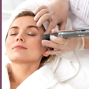 Microneedling-Treatment-in-Evesham-and-caci-non-surgical-face-lift-evesham-and-serving-Pershore,-Broadway,-Alcester,-Stratford